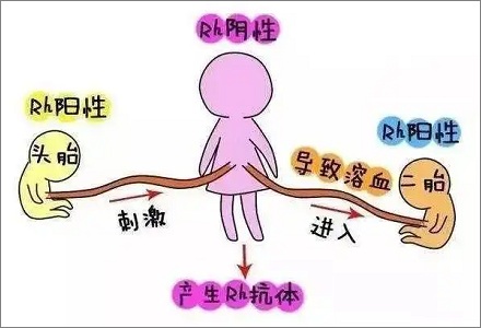 Rh 阴性血的妈妈只能生一个孩子？