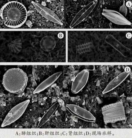 为什么法医要凭借水藻来判断是溺水还是谋杀?