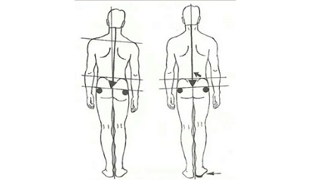 为什么招飞行员体检时，「屁股不对称」的人可能被刷？