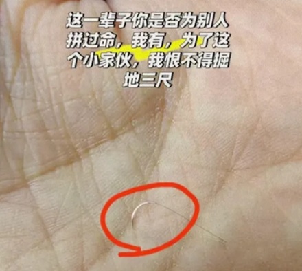 为什么手术中护士最怕听到主刀医生说 10-0 的针掉了?