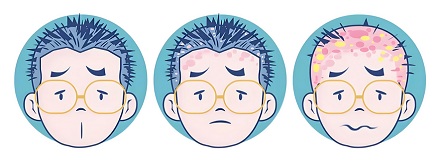 头皮上的黄色小颗粒,到底是啥?