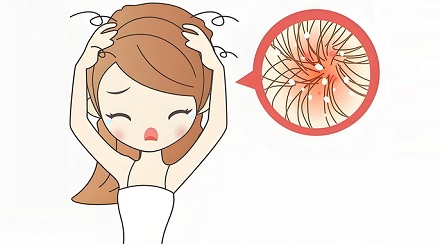 头皮上的黄色小颗粒,到底是啥?
