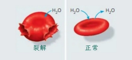 用注射器往一个人臀部注射一管目来水，这个人会怎么样？
