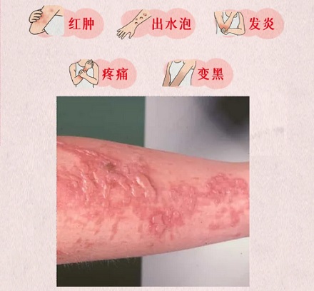 在夏天的阳光下剥橙子,为什么是作死?