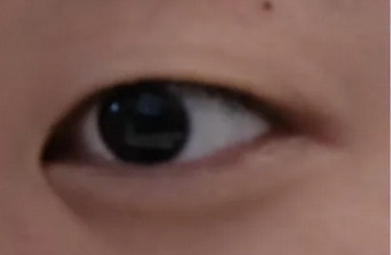 为什么有的人下眼睑最外面会有一条线?
