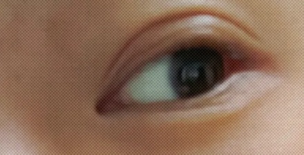 为什么有的人下眼睑最外面会有一条线?